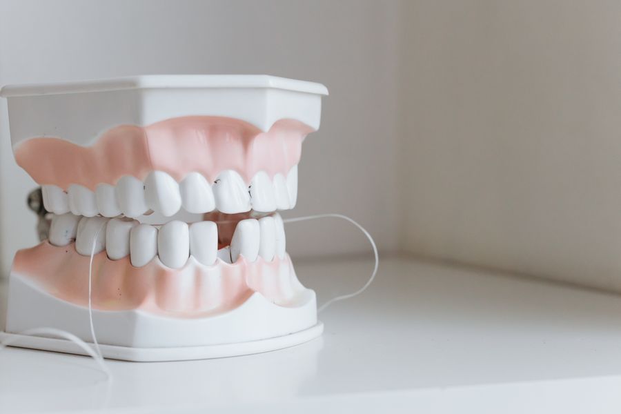 implant dentar pret Cluj